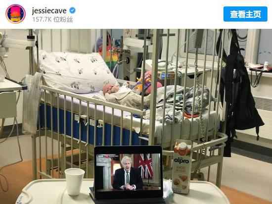 《哈利波特》影戏演员幼子传染新冠 出生仅3个月